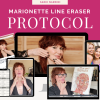 Marionette Line Eraser Protocol